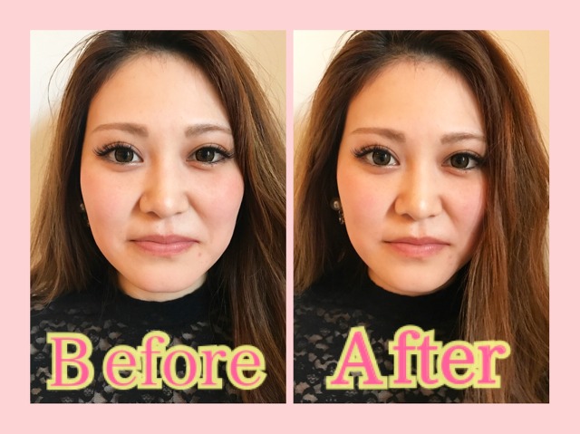 BeforeAfter