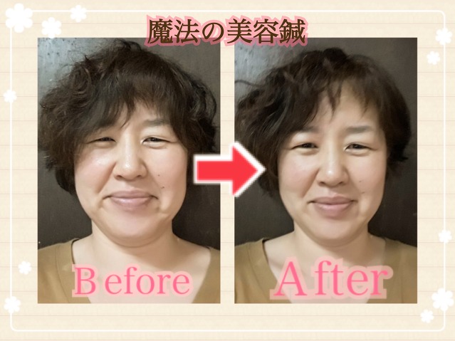 BeforeAfter